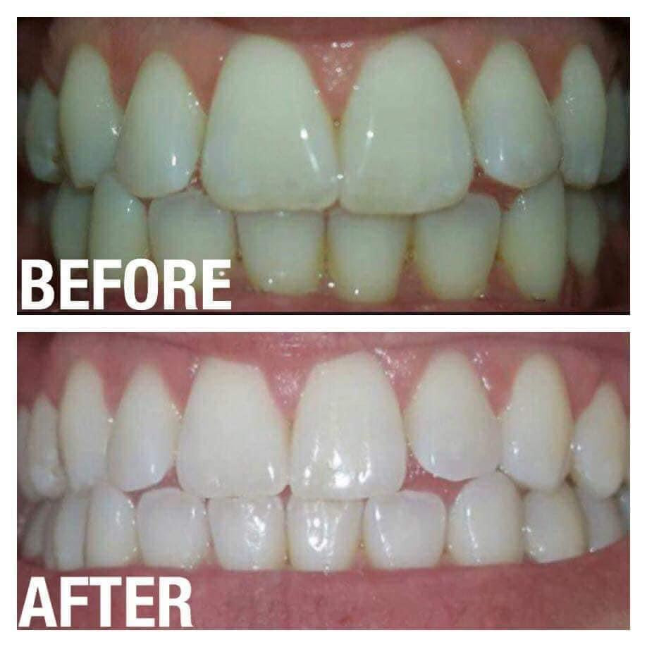 NuSkin: AP 24 Whitening Toothpaste - 1 for $18