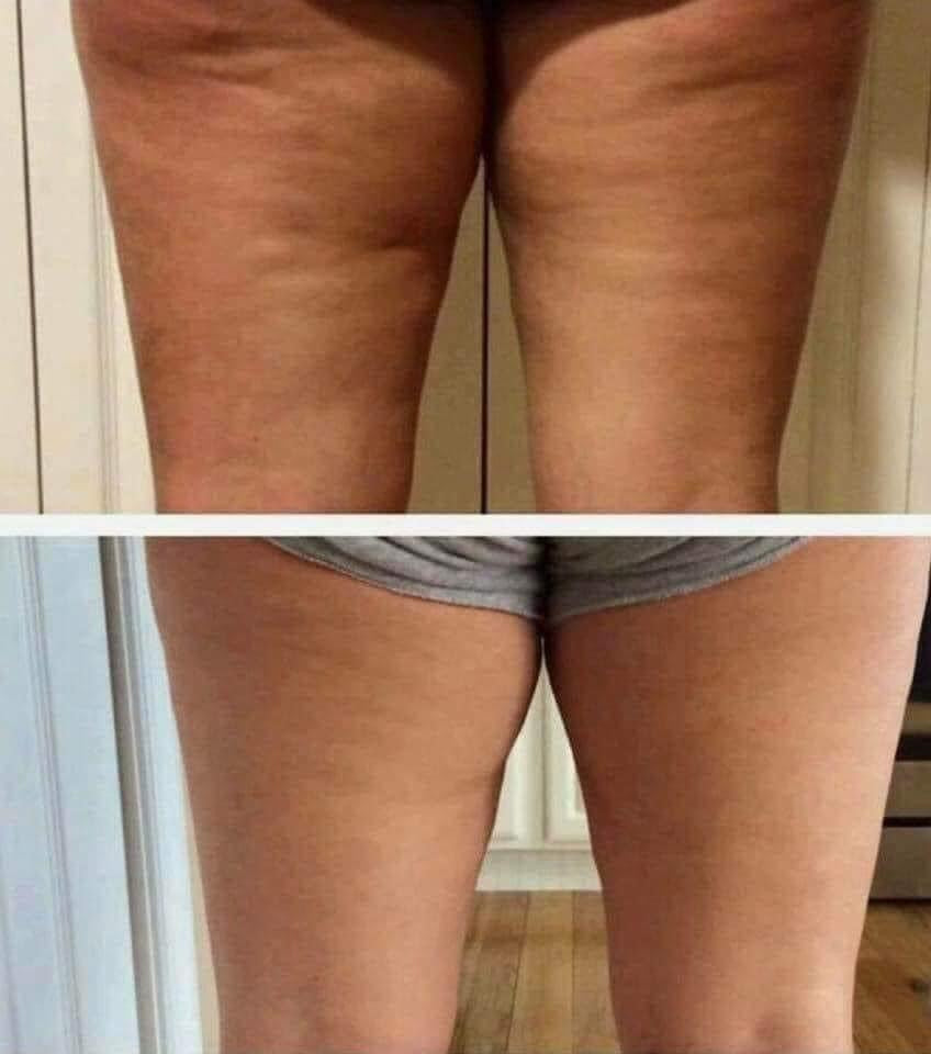 NuSkin: ReNu Spa for muscle recovery, loose skin, and cellulite = Restore, Revitalize, Refresh