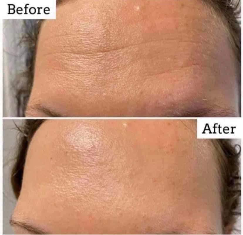 NuSkin: TruFace Line Corrector = Peptide Refining Gel