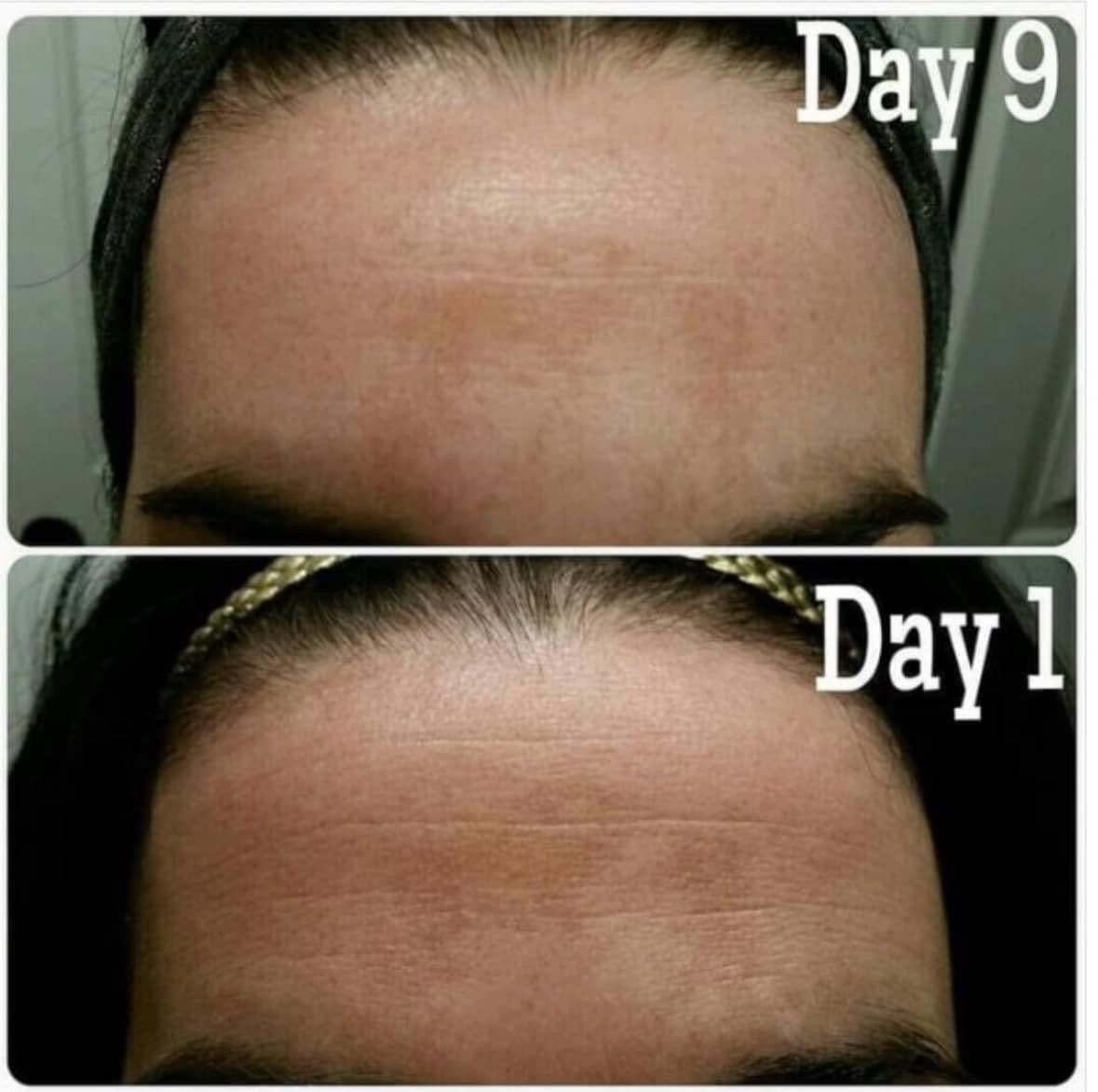 NuSkin: TruFace Essence Ultra - 'Botox Beads' = $50 OFF!