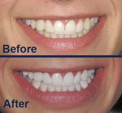 NuSkin: AP 24 Whitening Toothpaste - 1 for $18