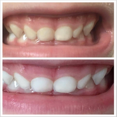 NuSkin: AP 24 Whitening Toothpaste - 1 for $18