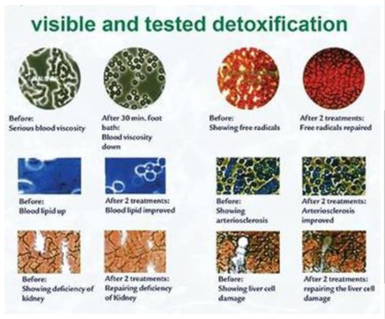Wellness: In-home Ionic Detox Footbath Treatment -- text to book